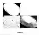 Fig. 02 - Methods of detecting biological prints, fluids or analytes therein using porous semiconductor substrates