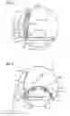 Fig. 03 - MAGNETIC RESONANCE-LOCAL COIL ARRANGEMENT WITH AN OPTIMIZED WORKFLOW