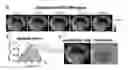 Fig. 01 - Methods and systems of assessing tissue vascular permeability using non-labeled dextran