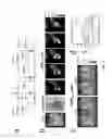 Fig. 03 - Methods and systems of assessing tissue vascular permeability using non-labeled dextran