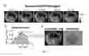 Fig. 05 - Methods and systems of assessing tissue vascular permeability using non-labeled dextran