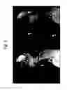 Fig. 04 - Motion corrected simultaneously acquired multiple contrast coronary MRI systems and methods