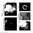 Fig. 09 - Motion corrected simultaneously acquired multiple contrast coronary MRI systems and methods