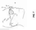 Fig. 12 - Imaging light guide with reflective turning array