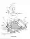 Fig. 16 - Heads up display systems for glasses