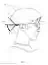 Fig. 02 - Adjustable eyewear retainer