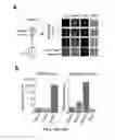 Fig. 11 - SINGLE-CELL ANALYSIS AS A SENSITIVE AND SPECIFIC METHOD FOR EARLY CANCER DETECTION