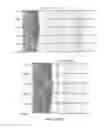 Fig. 37 - SINGLE-CELL ANALYSIS AS A SENSITIVE AND SPECIFIC METHOD FOR EARLY CANCER DETECTION