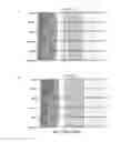 Fig. 48 - SINGLE-CELL ANALYSIS AS A SENSITIVE AND SPECIFIC METHOD FOR EARLY CANCER DETECTION