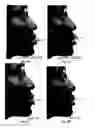 Fig. 11 - Image analysis for determining characteristics of pairs of individuals