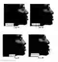 Fig. 15 - Image analysis for determining characteristics of pairs of individuals