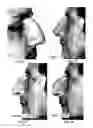 Fig. 18 - Image analysis for determining characteristics of pairs of individuals