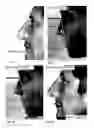 Fig. 19 - Image analysis for determining characteristics of pairs of individuals