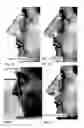 Fig. 20 - Image analysis for determining characteristics of pairs of individuals