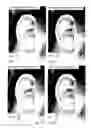 Fig. 27 - Image analysis for determining characteristics of pairs of individuals