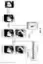 Fig. 06 - Free-breathing parameter mapping with high-contrast image registration