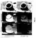 Fig. 09 - Free-breathing parameter mapping with high-contrast image registration