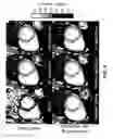 Fig. 10 - Free-breathing parameter mapping with high-contrast image registration
