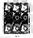 Fig. 11 - Free-breathing parameter mapping with high-contrast image registration