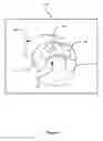 Fig. 10 - Method, system and apparatus for displaying surgical engagement paths