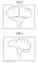 Fig. 03 - Image processing apparatus and magnetic resonance imaging apparatus