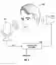 Fig. 05 - Natural ear