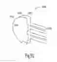Fig. 62 - Flat capacitor for an implantable medical device