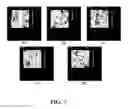 Fig. 07 - Silicon sputtering target with special surface treatment and good particle performance and methods of making the same