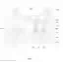 Fig. 02 - Manufacture method of AMOLED back plate and structure thereof