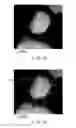 Fig. 10 - Active material, nonaqueous electrolyte battery, battery pack, and vehicle