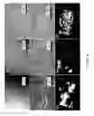 Fig. 05 - Nanostructured carbon electrode, methods of fabricating and applications of the same