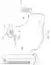 Fig. 02 - Thermal safety plug for an electric appliance