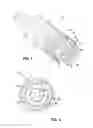 Fig. 04 - Multi-electrode spark plug