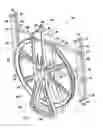 Fig. 02 - Cable guide actuation apparatus