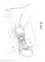 Fig. 30 - Endoscope with pannable camera and related method