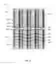 Fig. 09 - Self aligning imager array