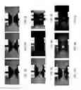 Fig. 05 - Image analysis system and method