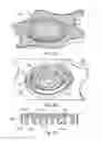 Fig. 03 - Fabricating an integrated loudspeaker piston and suspension