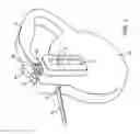 Fig. 02 - RETRACTABLE LEASH SYSTEM