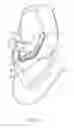 Fig. 03 - SEPARABLE FACE MASK STRUCTURE
