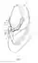 Fig. 04 - SEPARABLE FACE MASK STRUCTURE