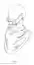 Fig. 07 - SEPARABLE FACE MASK STRUCTURE