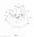 Fig. 02 - Sterilized Gown