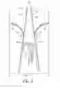 Fig. 04 - GARMENT SIZE ADJUSTMENT ASSEMBLY