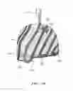Fig. 10 - Artificial hair apparatus and method
