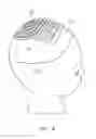 Fig. 16 - Artificial hair apparatus and method