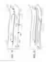 Fig. 12 - Footwear having sensor system