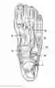 Fig. 01 - Orthopedic shoe appliance