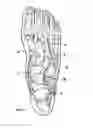 Fig. 02 - Orthopedic shoe appliance