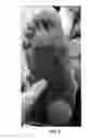 Fig. 03 - Orthopedic shoe appliance